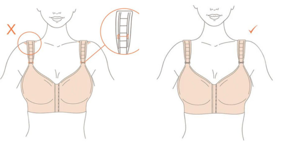 How to Find your Perfect Size Post-Surgery Bra | An Expert Guide
